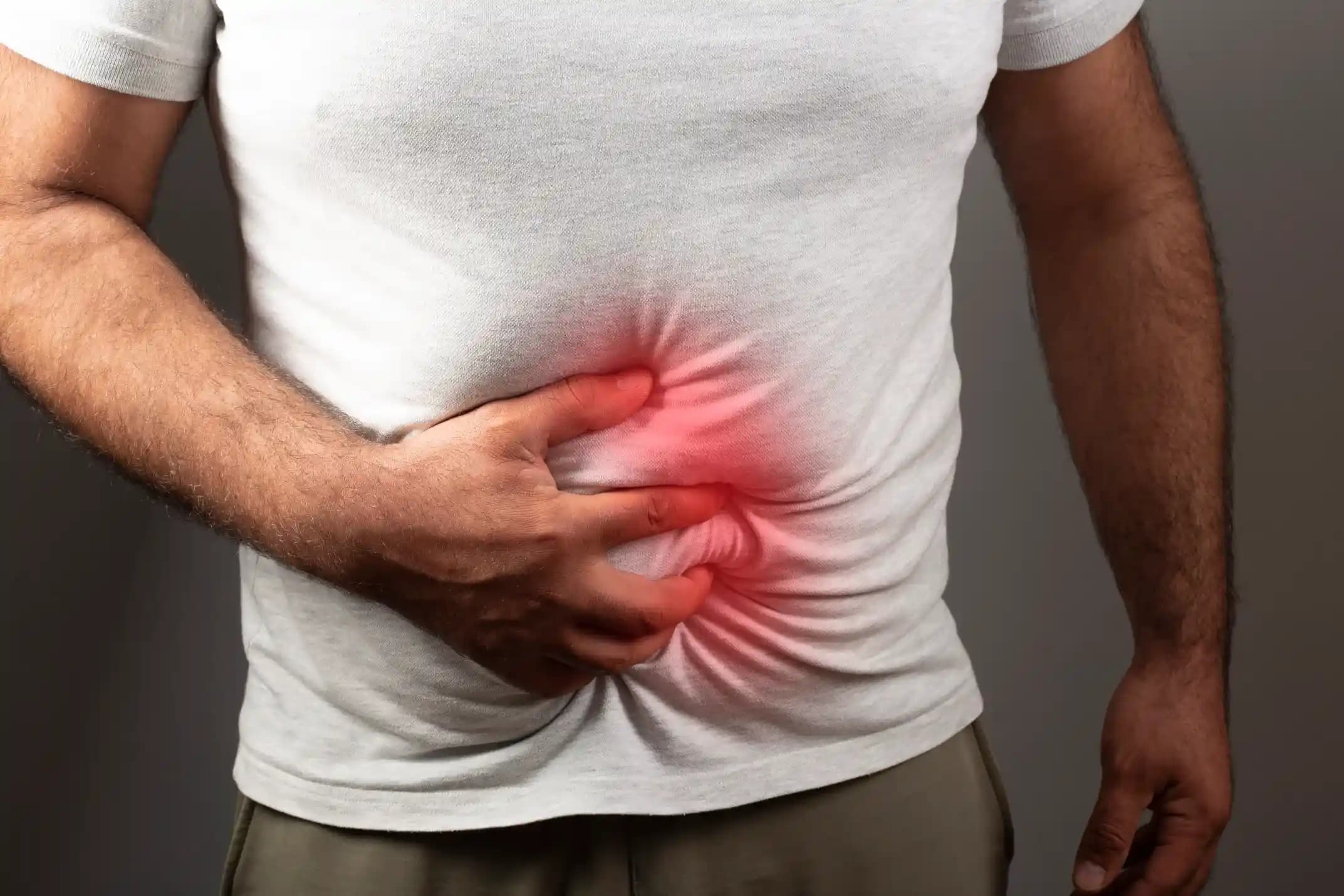 hernia