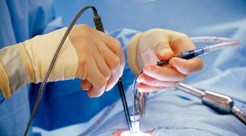 Laser surgery