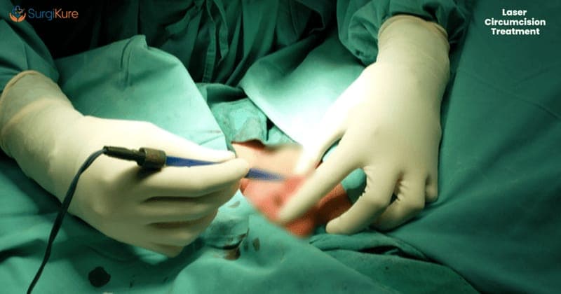 Circumcision